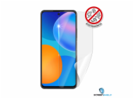 8531872