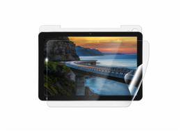 Screenshield IGET Smart W30 fólie na celé tělo