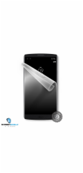 ScreenShield fólie na displej pro LG H900 V10